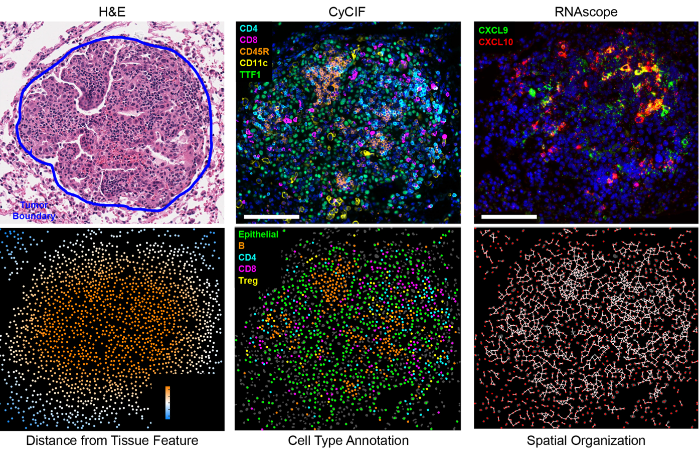 Lymphocyte Networks